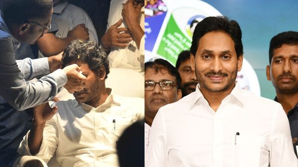 డ్యామిడ్.. జగన్ బ్యాండేజీ కథ అడ్డం తిరిగిందన్న టీడీపీ.. లోకేష్ సంచలన పోస్ట్!!