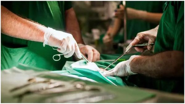 Amalapuram Woman: అమలాపురం మహిళ కడుపులో 570 రాళ్లు- అవాక్కయిన డాక్టర్లు..!