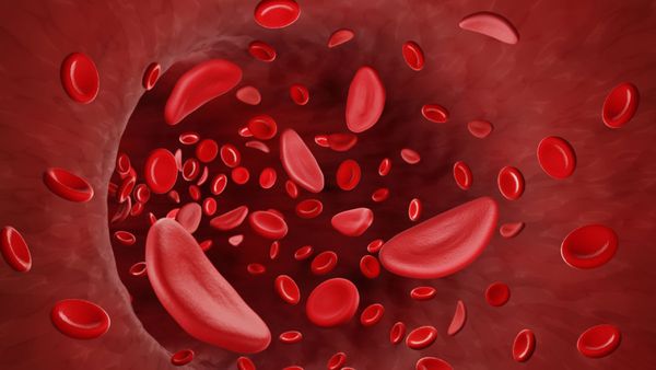 Sickle Cell disease: సికిల్ సెల్ ఎనీమియా అంటే ఏంటి? లక్షణాలేంటి?