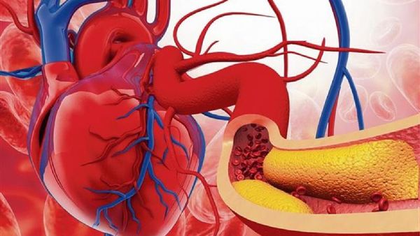 Heart News: చెడు కొలెస్ట్రాల్‌ కట్టడికి ఇవి తింటే సరి.. హృదయారోగ్యానికి బెస్ట్, గుండె సమస్యలకు చెక్