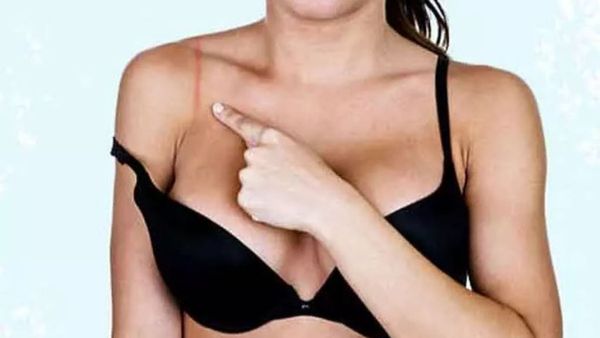  మహిళలు 'నో బ్రా డే' గుర్తుందా..?