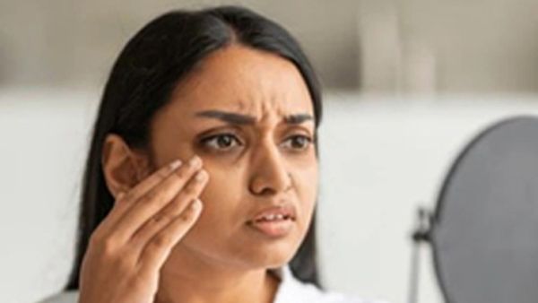 ముఖానికి ఇవి అసలే రాసుకోవద్దు.. చర్మం ఇస్తున్న హెచ్చరిక!