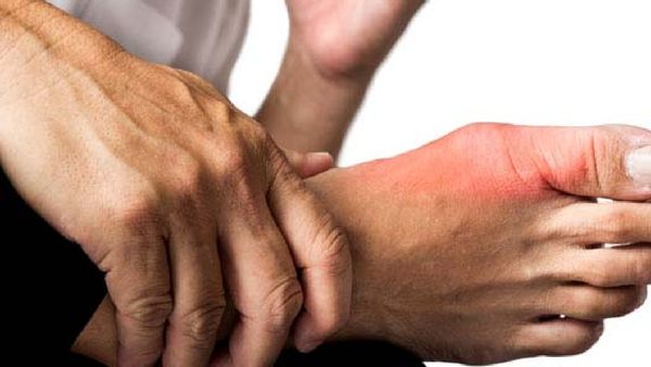 శరీరంలో యూరిక్ యాసిడ్ స్థాయిలు పెరిగితే ఎంత డేంజరో తెలుసా? జాగ్రత్త మరి.