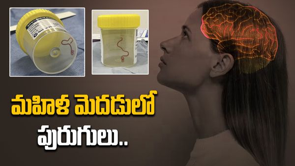 మహిళ మెదడులో పురుగులు. స్ట్రీట్ ఫుడ్ తినడం వల్లే..! వైద్యుల మైండ్ బ్లాంక్..
