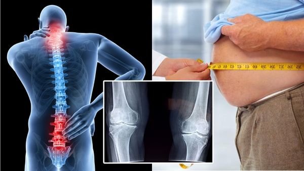 బరువు పెరిగితే ఎముకలకు డేంజర్... జాగ్రత్త!