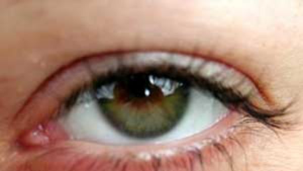 కంట్లో పదునైన నొప్పి.. కారణాలివే కావచ్చు.. నిర్లక్ష్యం చెయ్యొద్దు!