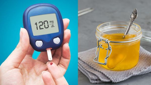 షుగర్ ఉన్నవారు నెయ్యి తింటున్నారా? అయితే ఒక్కసారి ఇవి తెలుసుకోండి.. లేకపోతే మీకే ఇబ్బంది!