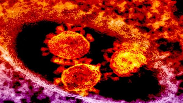 చావుకు ముందు కోమాలోకి.. వణికిస్తున్న కరోనా కొత్త వేరియంట్ లక్షణాలు..?