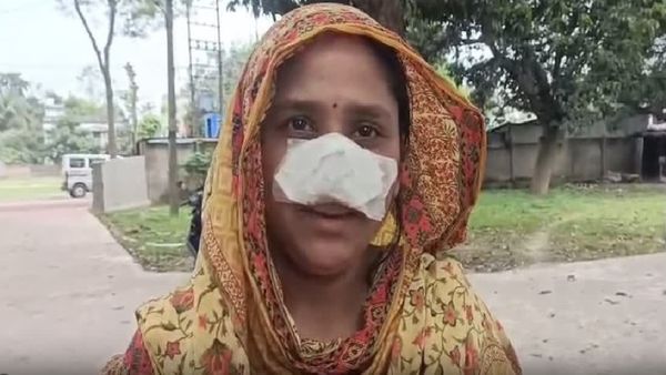 భార్య ముక్కు బాగుందని కొరికి తిన్న భర్త.. ఇదేం పిచ్చి బాబు !