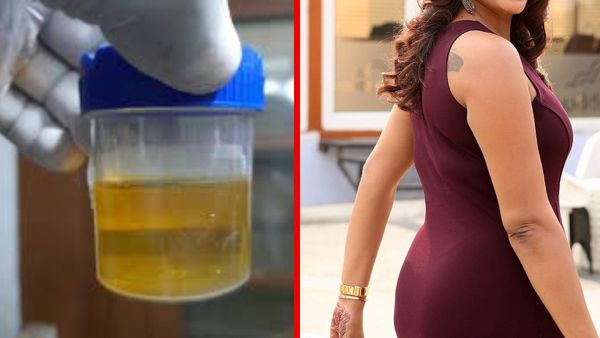 నా యూరిన్ నేనే తాగాను..హీరోయిన్ షాకింగ్ కామెంట్స్