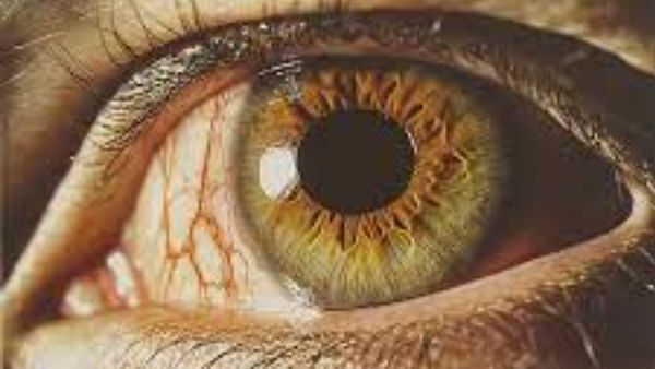 కంటి క్షయ గురించి మీకు తెలుసా? నిర్లక్ష్యం చేస్తే చూపు కోల్పోతారు