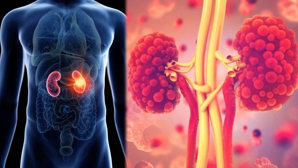 కిడ్నీ పనితీరు మెరుగవ్వాలంటే - ఈ ఆహారాలు వదిలేయండి..!!