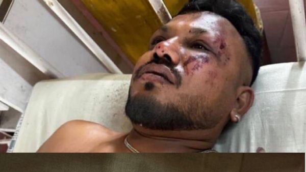 Viral Video:ఎయిరిండియా ఫ్లైట్ పేలిపోతుంటే.. పొగల్లో నుంచి కూల్ గా..! తాజా వీడియో..