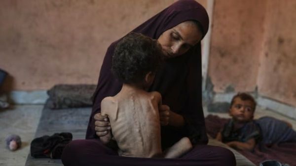 నేను ఇంకా అందంగానే ఉన్నానా ?.. ప్రపంచాన్ని కంటతడి పెట్టిస్తున్న 