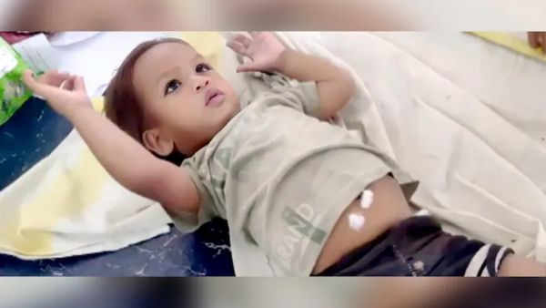 వీడు మామూలోడు కాదు బాబోయ్.. పుట్టిన ఏడాదికే నాగు పామును కసకసా కొరికి చంపేశాడు..