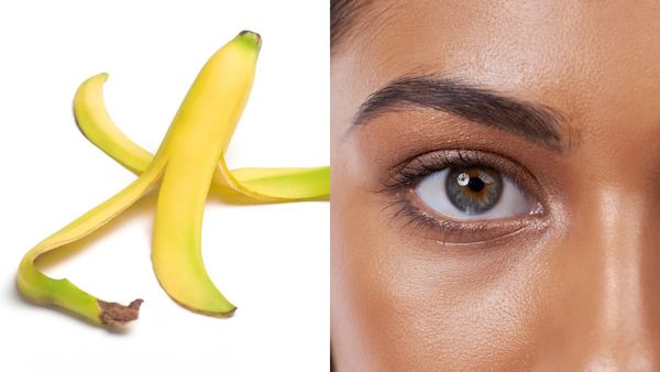 అరటి తొక్కే కదా అని పారేస్తున్నారా..? ఈ ప్రయోజనాలు మిస్​ అయినట్లే..!