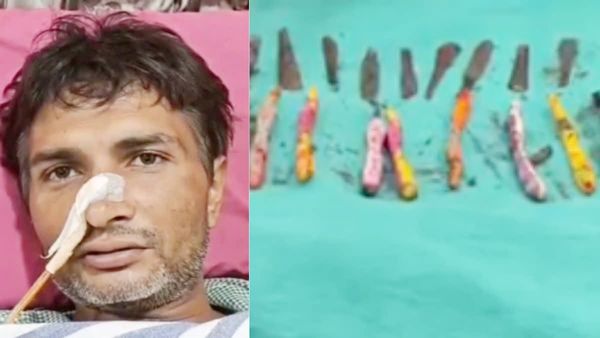 29 స్టీల్‌ స్పూన్లు, 19 టూత్‌ బ్రష్‌లను మింగేశాడు.. కారణం తెలిస్తే షాక్ అవుతారు..