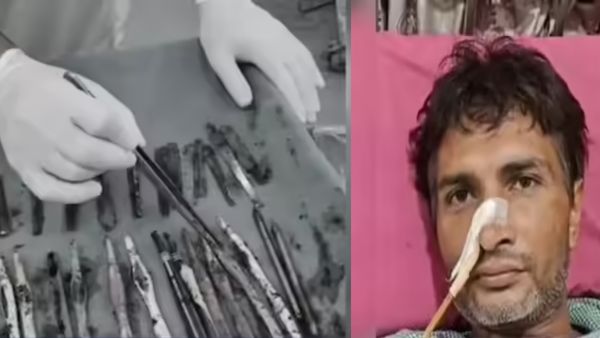 అది కడుపా.. లేక ఇంకేదైనా అనుకున్నావా బ్రో.. ఏమేం ఉన్నాయంటే ??