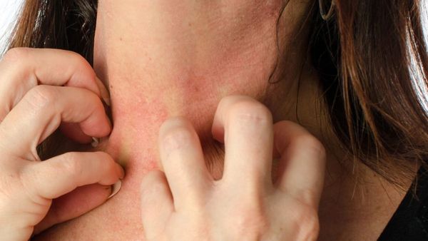 షుగర్ కంట్రోల్ లో లేకుంటే చర్మంపై ఈ సంకేతాలు.. జాగ్రత్త