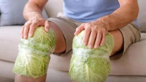 మోకాలినొప్పికి క్యాబేజీ ఆకుల ట్రీట్‌మెంట్.. పని చేస్తుందా?