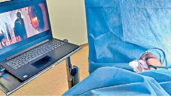 పవన్ కళ్యాణ్ మూవీ చూపిస్తూ బ్రెయిన్ సర్జరీ.. ఆపరేషన్ సక్సెస్ !!