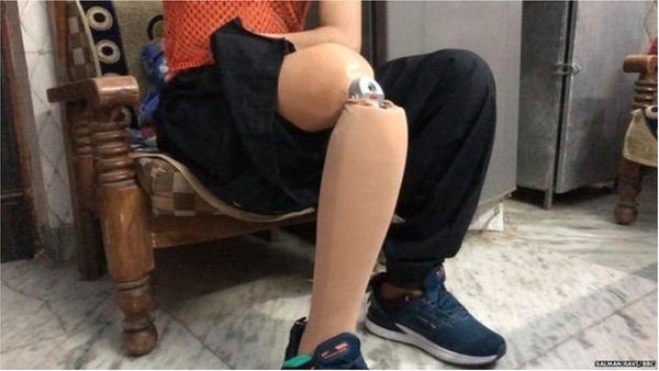 అఫ్గానిస్తాన్: వైద్యం కోసం ఇండియా వచ్చి తిరిగి వెళ్లలేక అవస్థలు పడుతున్న అఫ్గాన్ పౌరులు