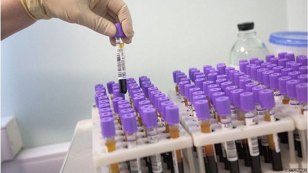 World Blood Donor Day: బ్లడ్ గ్రూప్స్ గురించి మీకేం తెలుసు... వాటిలో చాలా అరుదుగా దొరికే రక్తం రకాలు ఏంటి?