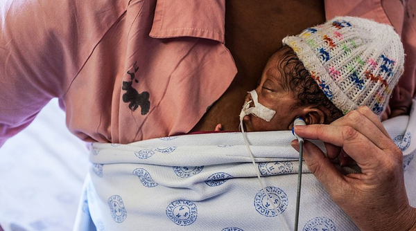 నెలలు నిండకుండా పుట్టే శిశువులను కాపాడే ‘‘కంగారూ కేర్’’ ఏమిటి?