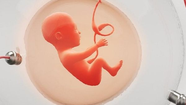 గుండె చికిత్స: తల్లి కడుపులోని బిడ్డ గుండెకు ఆపరేషన్... ‘‘ద్రాక్ష పండు’’ సైజులో గుండె... తేడా వస్తే ప్రాణం పోతుంది