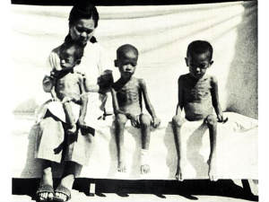 malnutrition malnutrition