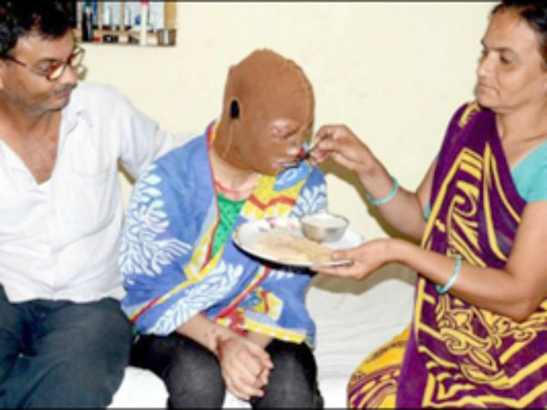 Mehsana acid attack Mehsana acid attack