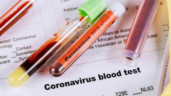 Coronavirus Coronavirus