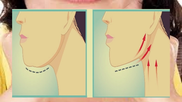 Double chin fat