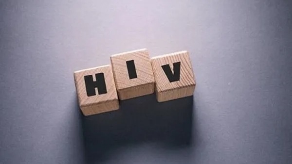 HIV infection HIV infection