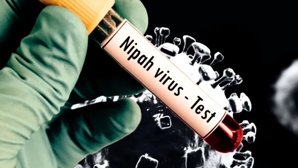Nipah Virus