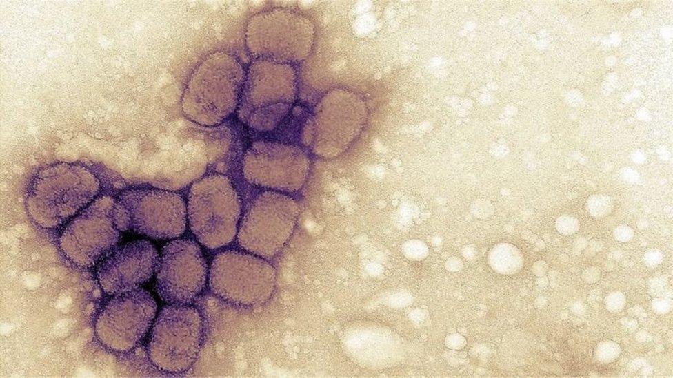 1980માં શીતળાનો રોગ નાબૂદ થયો હતો