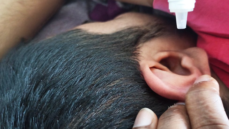 કાનમાં ઇયર ડ્રોપ્સ નાખી રહ્યા છે કાનમાં ઇયર ડ્રોપ્સ નાખી રહ્યા છે