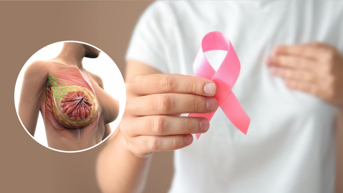 Breast Cancer: जर्मन मॉडल का स्तन कैंसर से निधन, जानिए कितनी गंभीर है यह बीमारी?