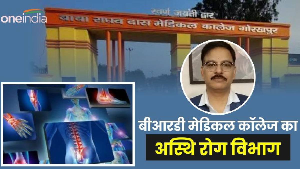 Gorakhpur News: BRD Medical College का अस्थि रोग विभाग मरीजों को दे रहा ये बड़ी सुविधाएं,HOD ने बताई विशेषताएं