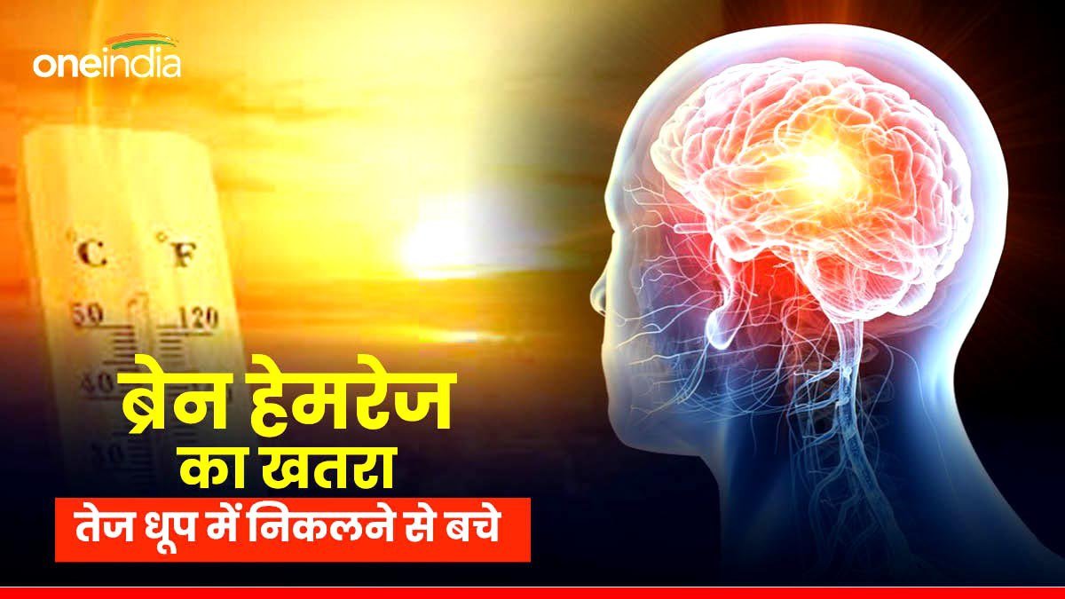Bhopal News: एसी और कूलर की हवा से निकलकर सीधे तेज धूप में जाने से बचे, ब्रेन हेमरेज का बढ़ा खतरा