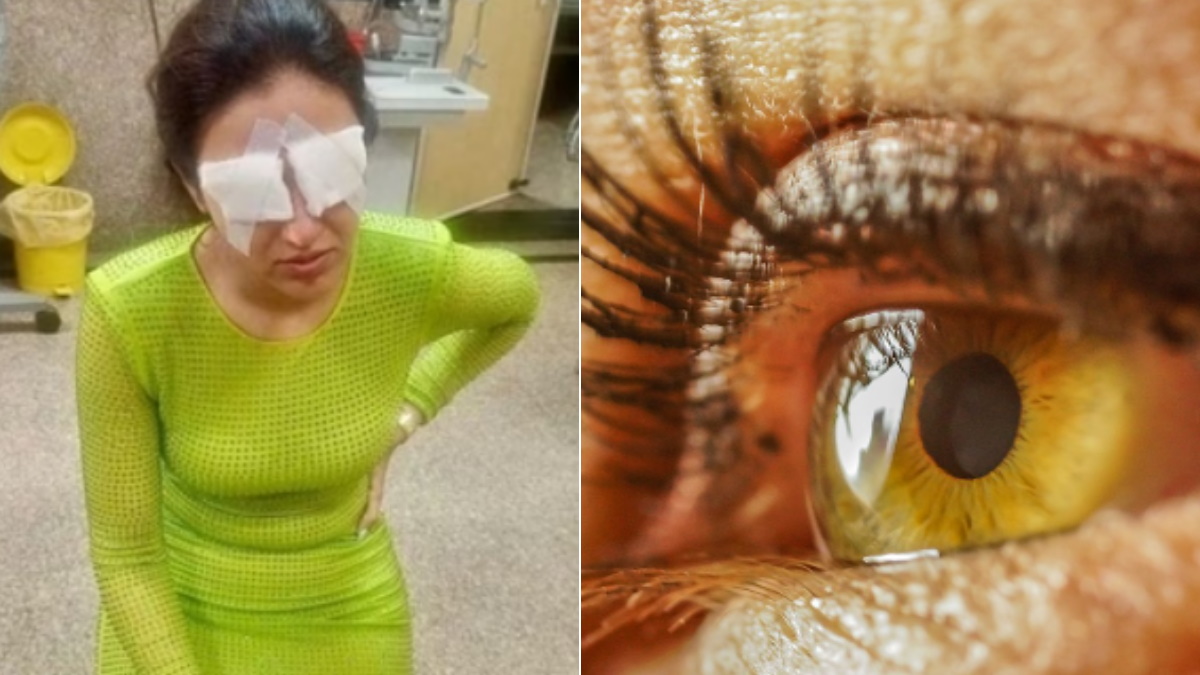 कॉन्टेक्ट लेंस लगाकर एक्ट्रेस को दिखना हुआ बंद, आप भी संभल जाएं वरना छिन सकती है आंखों की रोशनी