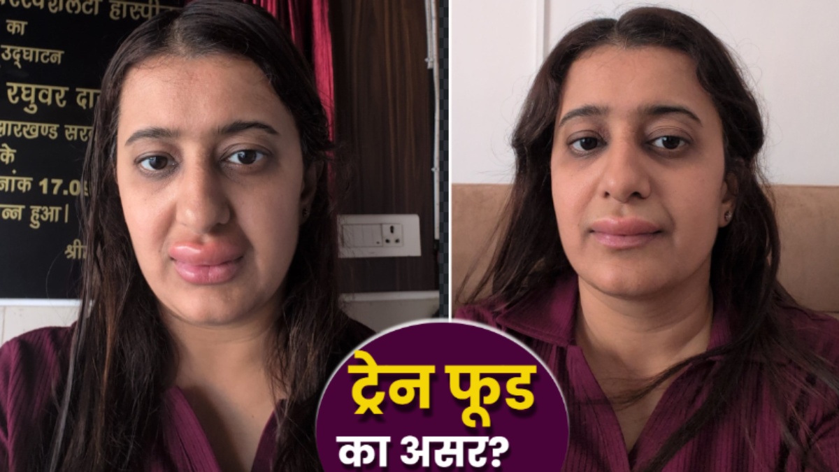 Ayushi Singh कौन हैं? Vande Bharat Train में ऐसा क्या खाया, जो भयानक सूजे होंठ? बेटा भी बीमार, कटघरे में IRCTC