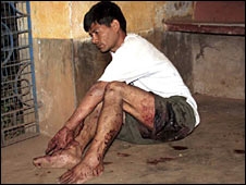 Maoist Attack Maoist Attack