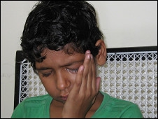 शिक्षिका की पिटाई से आंख गई शिक्षिका की पिटाई से आंख गई