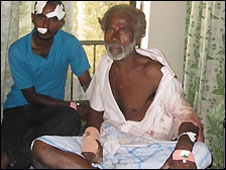 Srilanka Blast Srilanka Blast