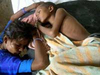 Japanese encephalitis patient Japanese encephalitis patient