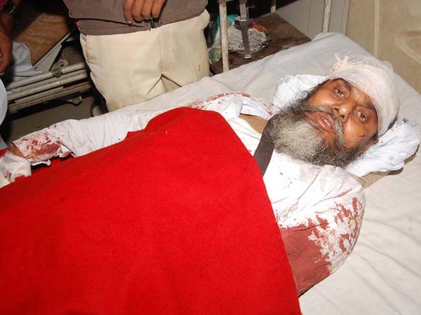 अस्पताल में घायल अस्पताल में घायल