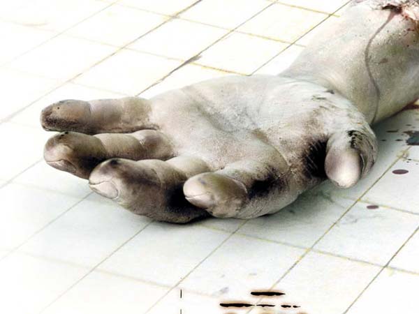 अपने ही अंग कटते हुए देखें 