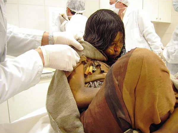 दोनों शव म्‍यूजियम में