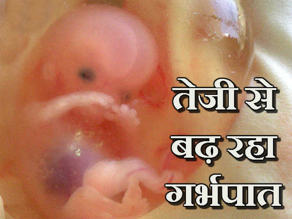 गांवों की तुलना में शहर में अधिक गर्भपात